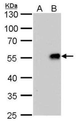 Influenza A H1N1 Neuraminidase Antibody (GT288) - (A/WSN/1933), Novus Biologicals 100 &mu;g | Buy Online | Novus Biologicals | Fisher Scientific
